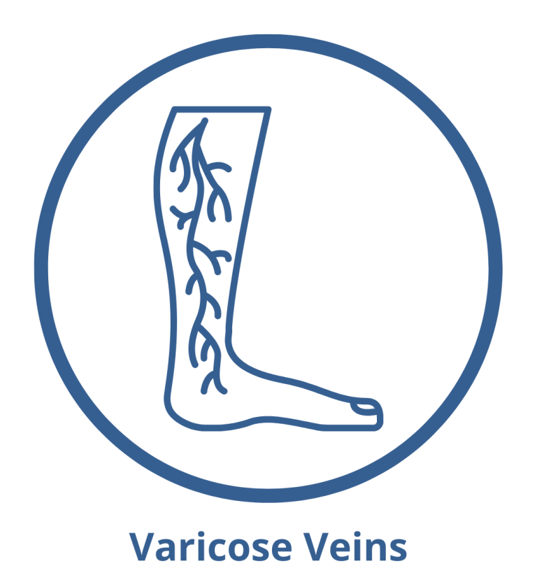 MIVIR Varicose Veins FAQs MIVIR